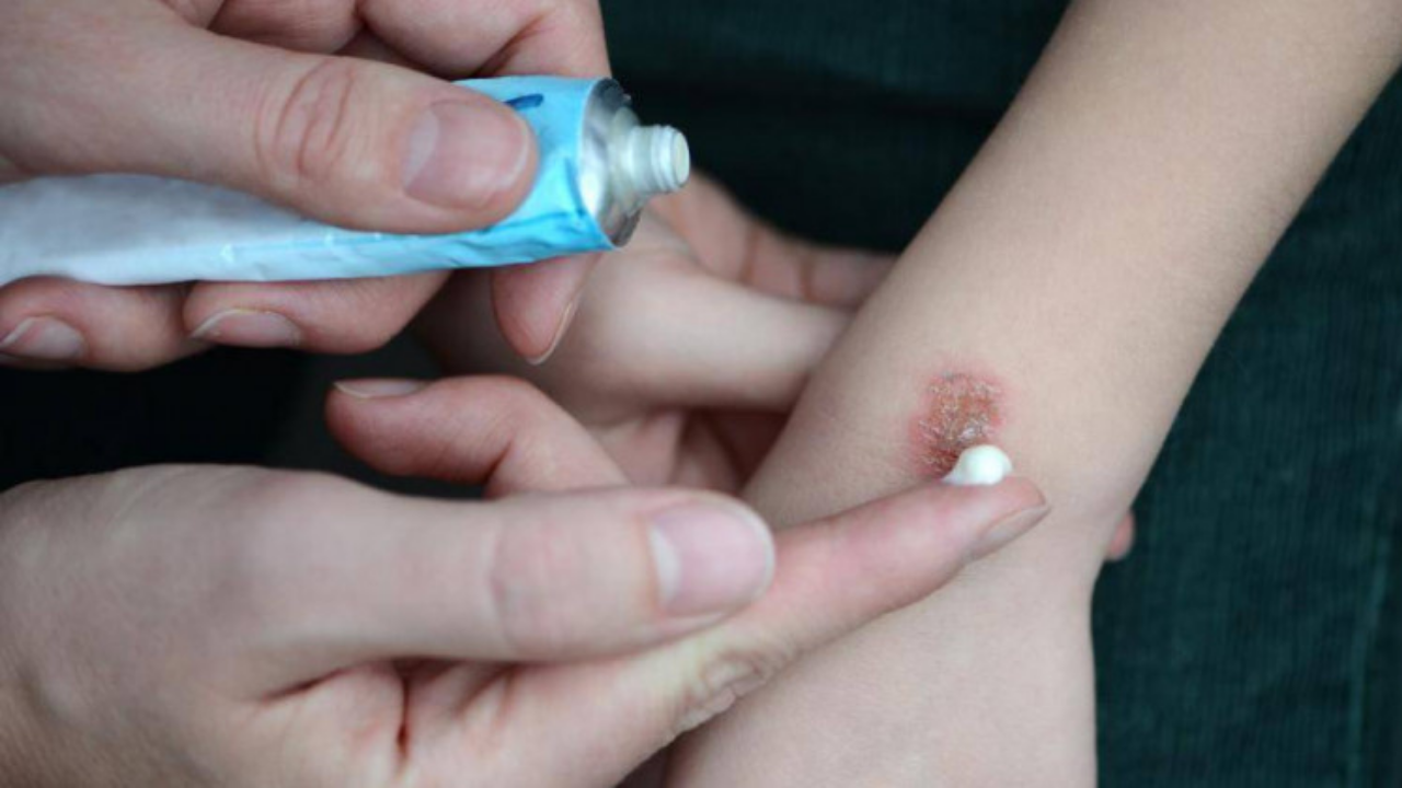 Ateş Kültürü (2)