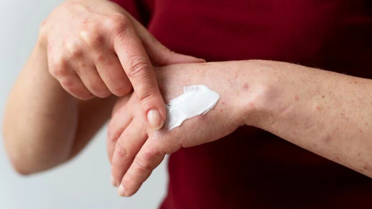 Ateş Kültürü (3)