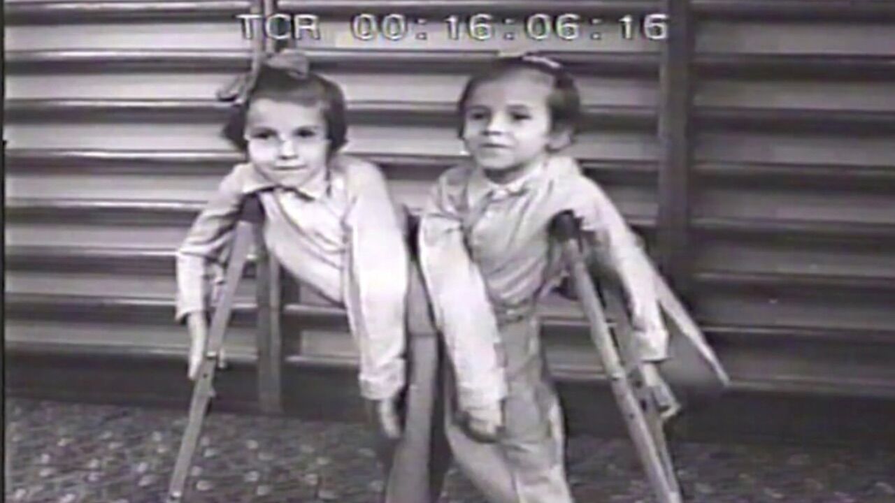 Yapışık Ikiz Deney 3