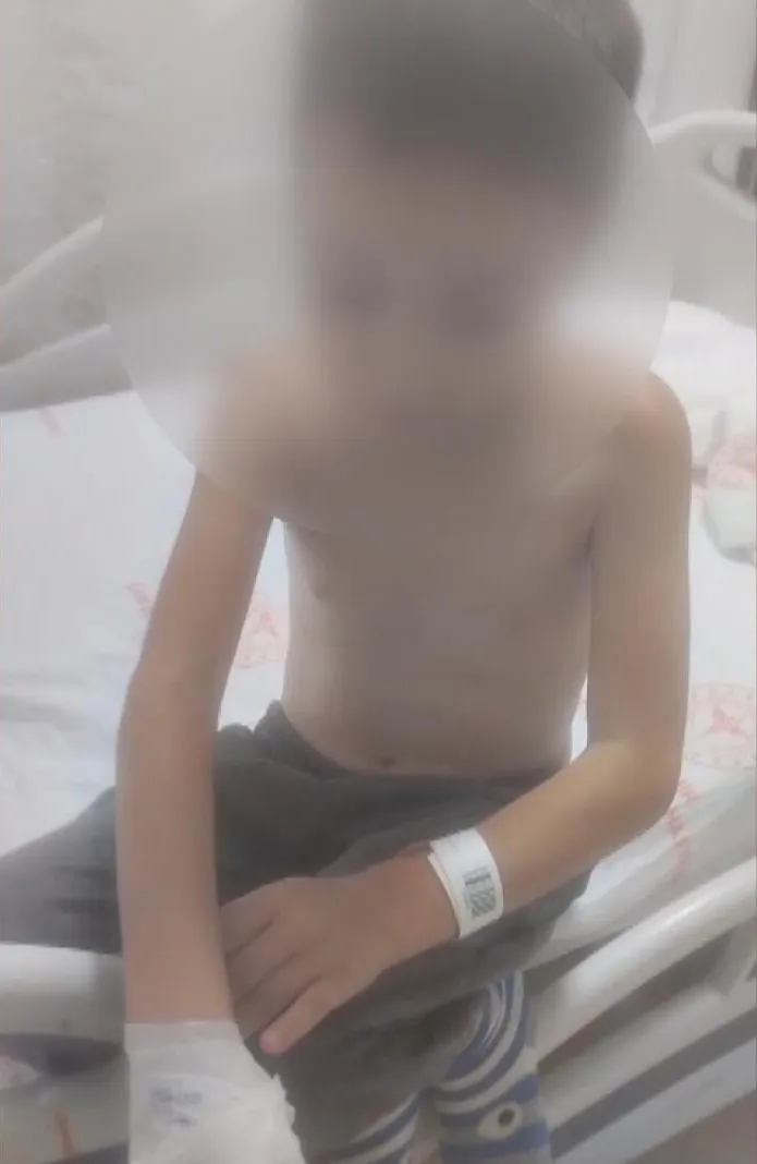 Arnavutköy'de dehşet anları: Arkadaş kurbanı 12 yaşındaki çocuğun sırtını ateşe verdiler