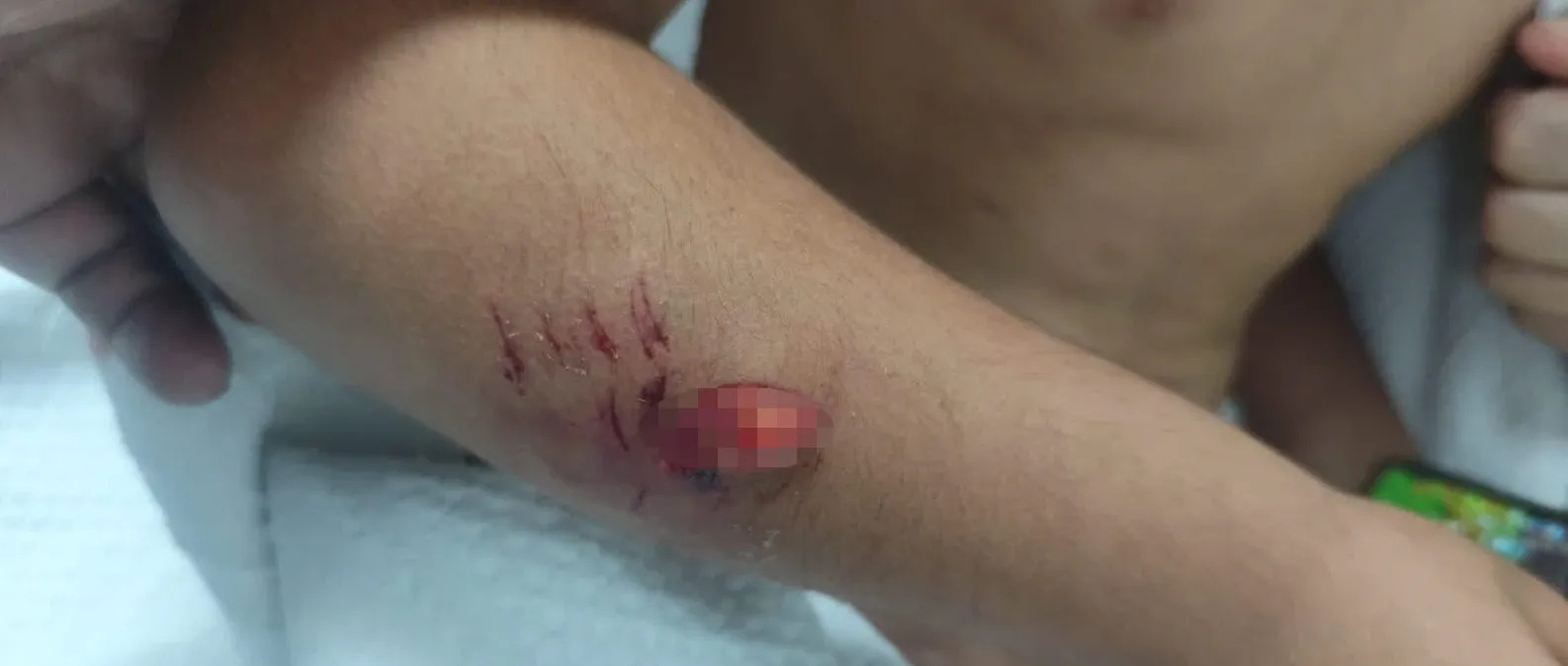 Viranşehir'de okul yolunda dehşet anları: 8 yaşındaki öğrenci köpeklerin hedefi oldu