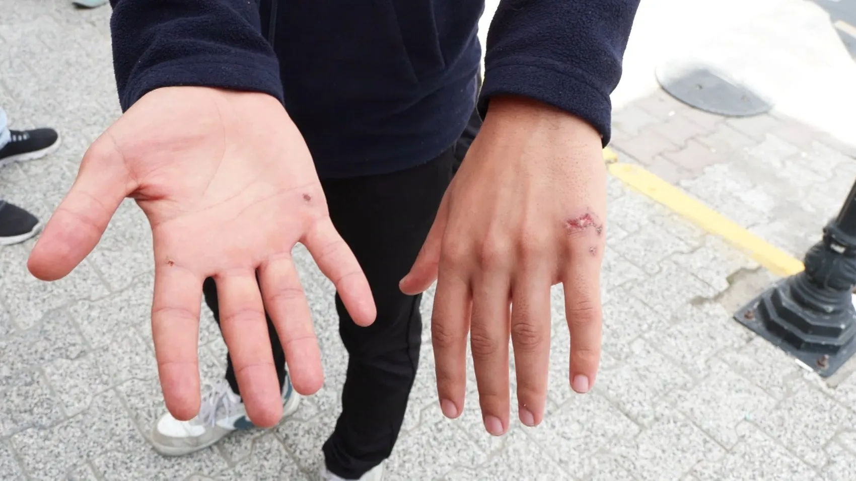 İşten atılma korkusuyla ölüme gönderildiler: Çocukluk arkadaşları yağmurda tabela montajına zorlandı
