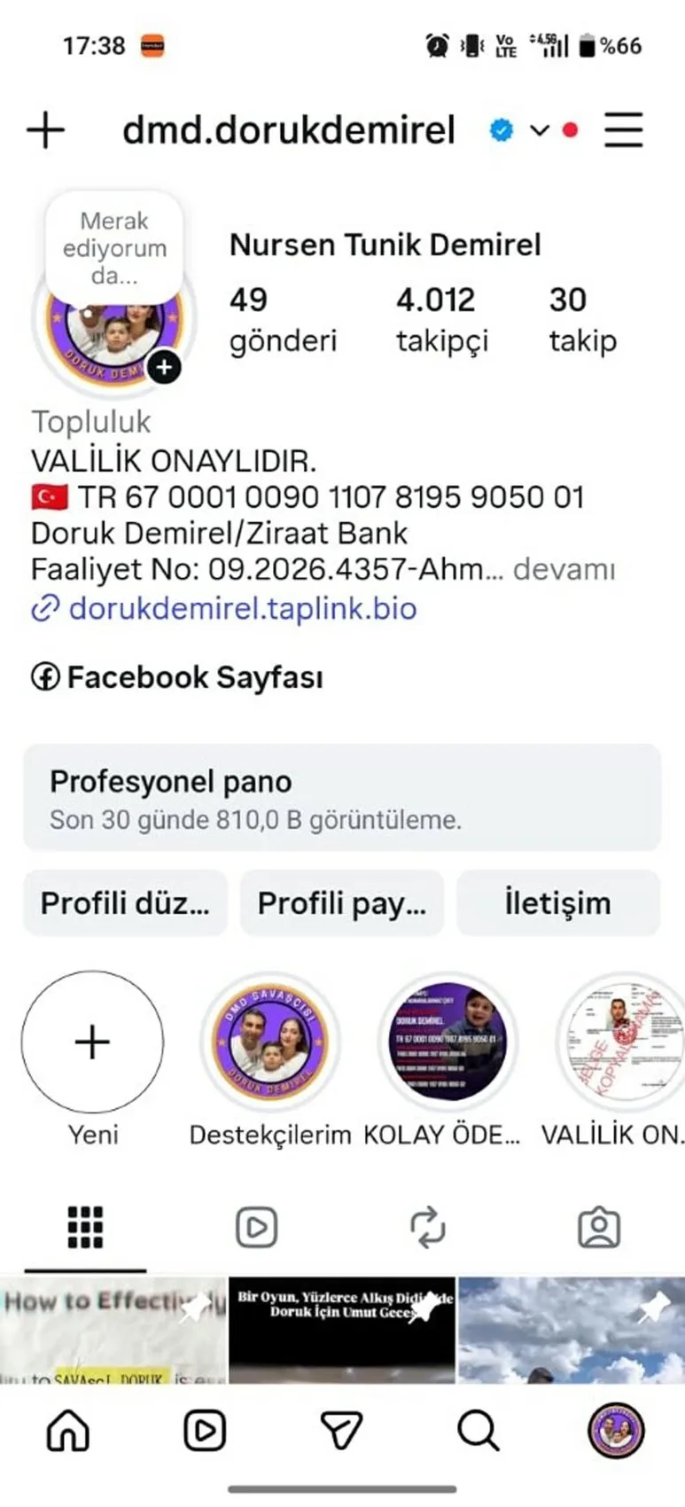 Doruk için zaman daralıyor: İkinci yaş gününde tek dileği kasları erimeden ilaca ulaşmak