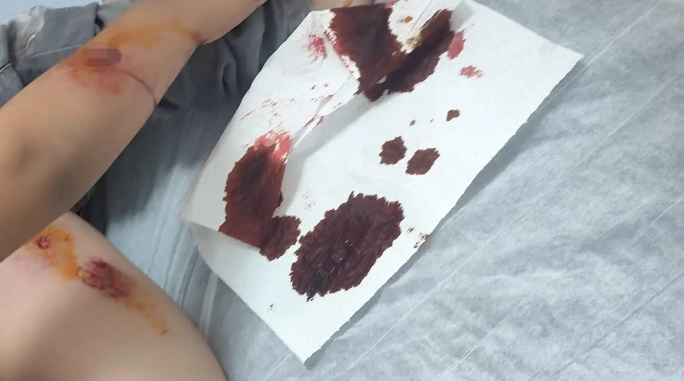 Viranşehir'de okul yolunda dehşet anları: 8 yaşındaki öğrenci köpeklerin hedefi oldu
