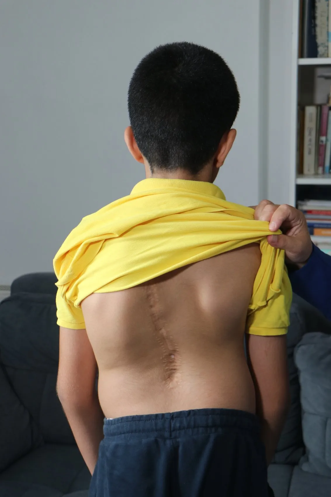 11 yaşındaki Cihan'ın en büyük hayali: Kendi gibi çocukları iyileştirecek doktor olmak