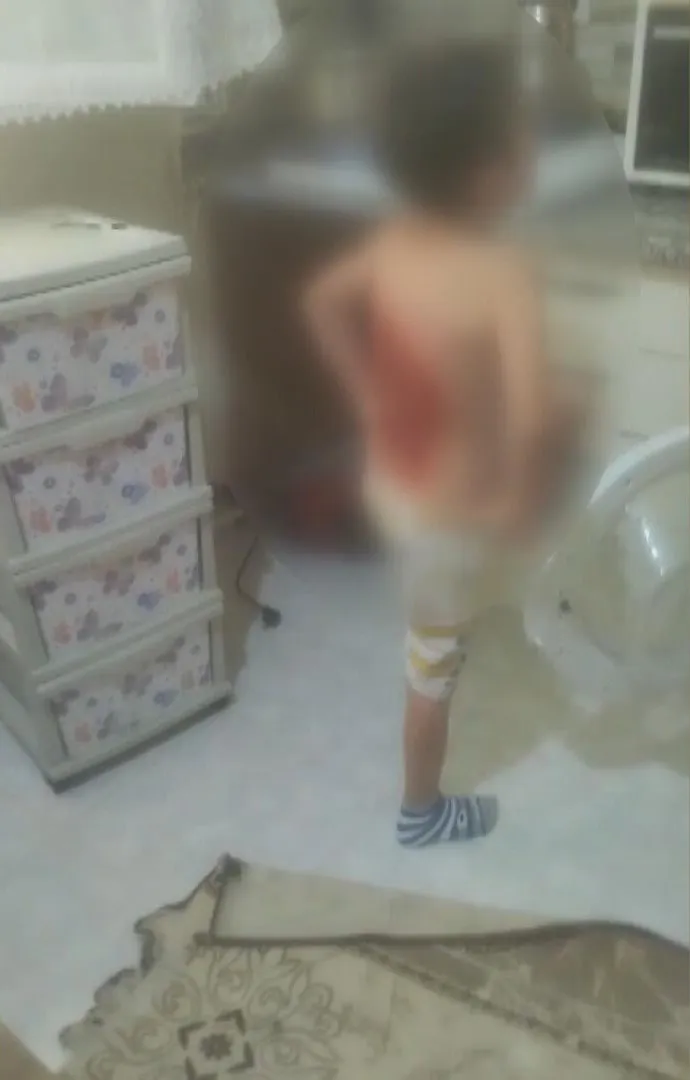 Arnavutköy'de dehşet anları: Arkadaş kurbanı 12 yaşındaki çocuğun sırtını ateşe verdiler