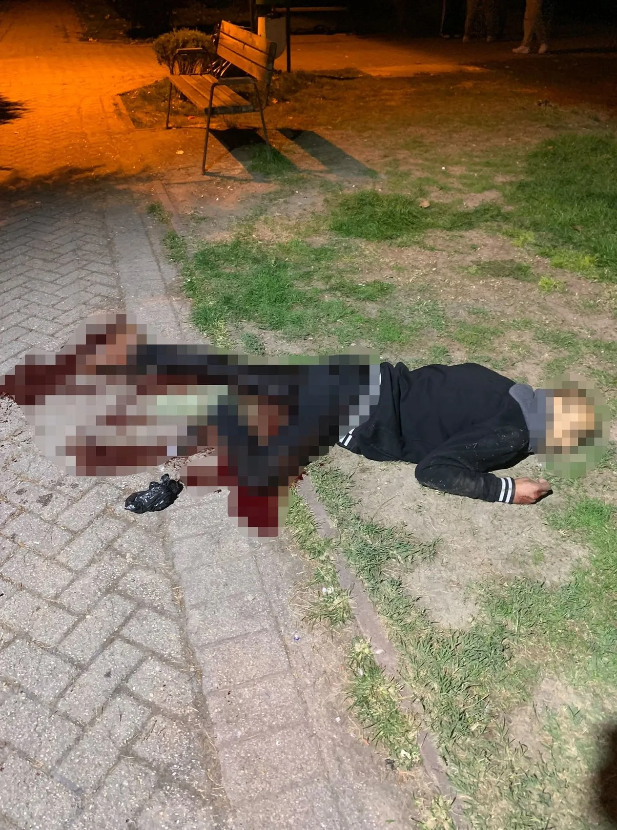 Eskişehir'de arkadaş kavgası kanlı bitti: Kalbi duran şahıs hayata döndürüldü