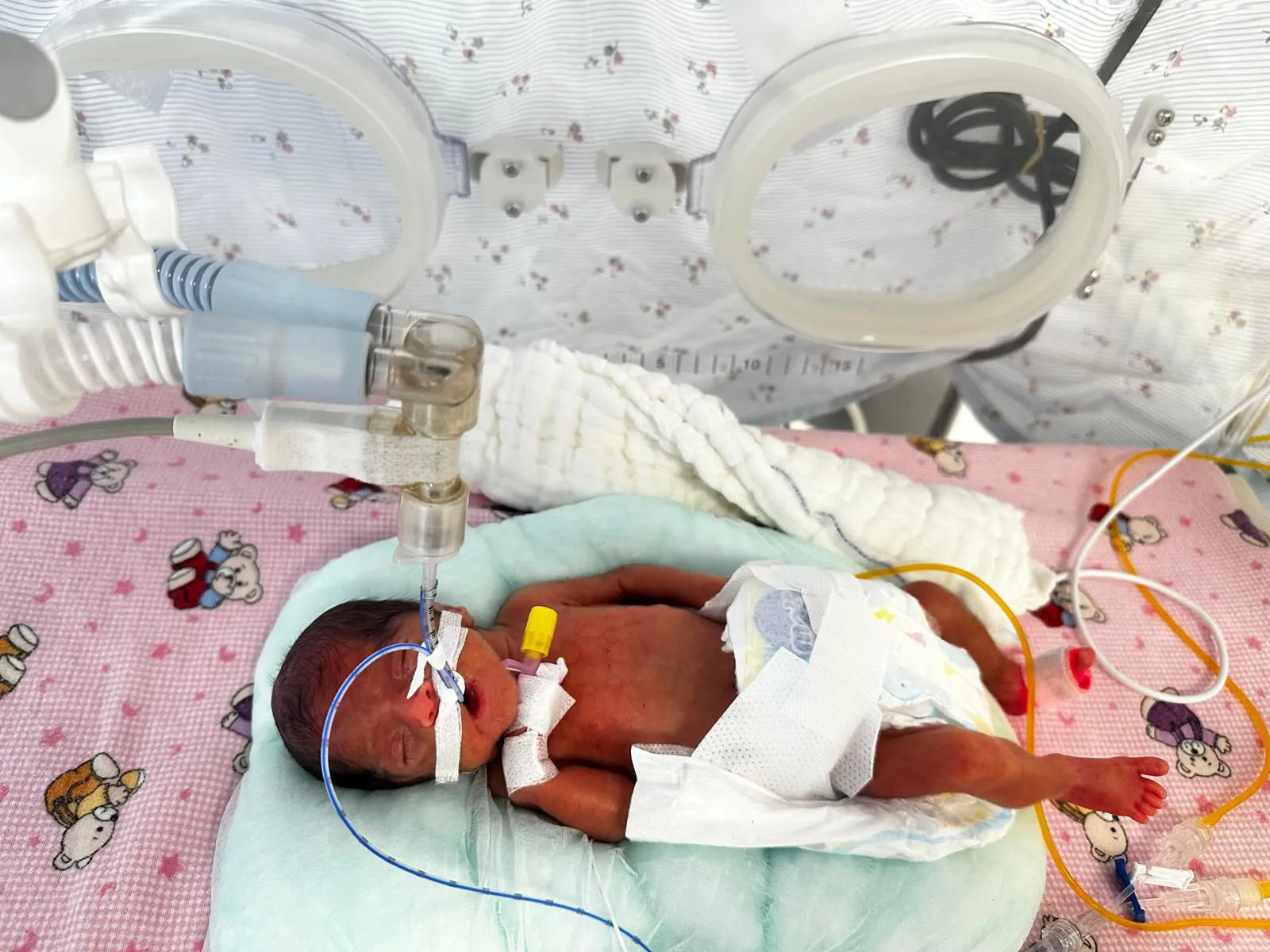 650 gramlık mucize Leyla bebek ailesine kavuştu