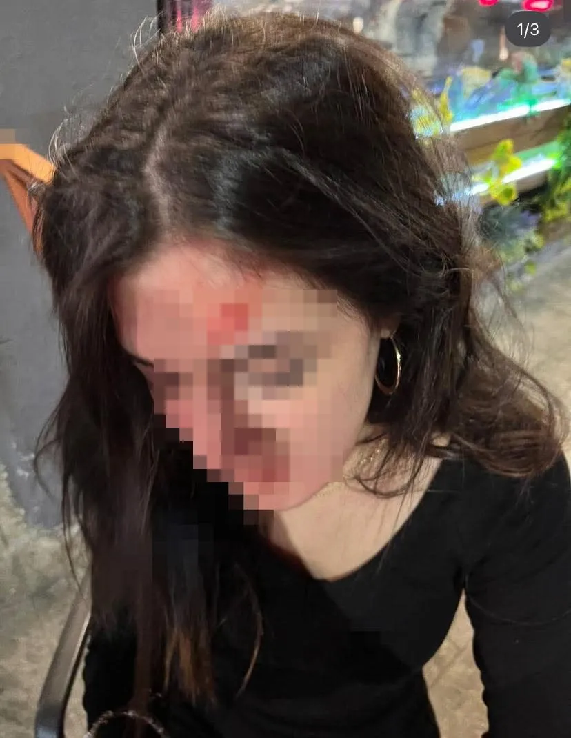 Samsun’da eski sevgili dehşeti kamerada