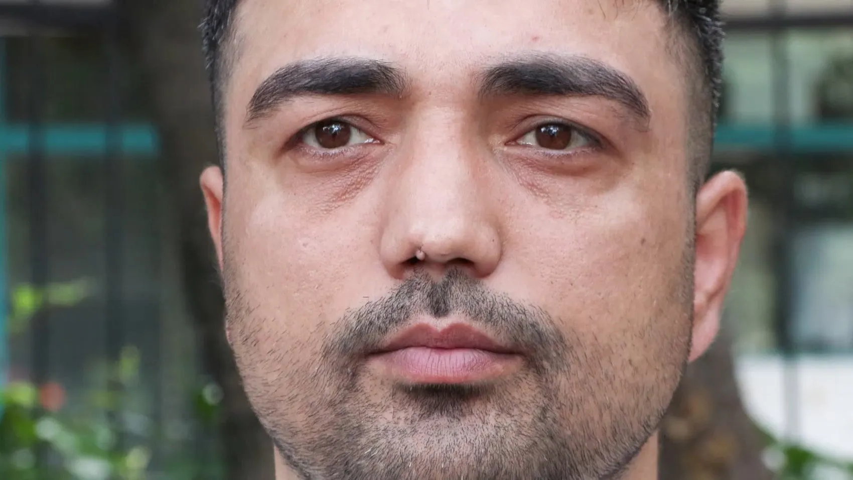 Dört ameliyatla hayatı karardı Horlama tedavisi kabusa döndü