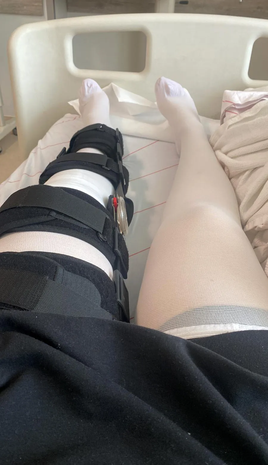 Sağ dizinden sakatlandı doktor sol dizini ameliyat etti
