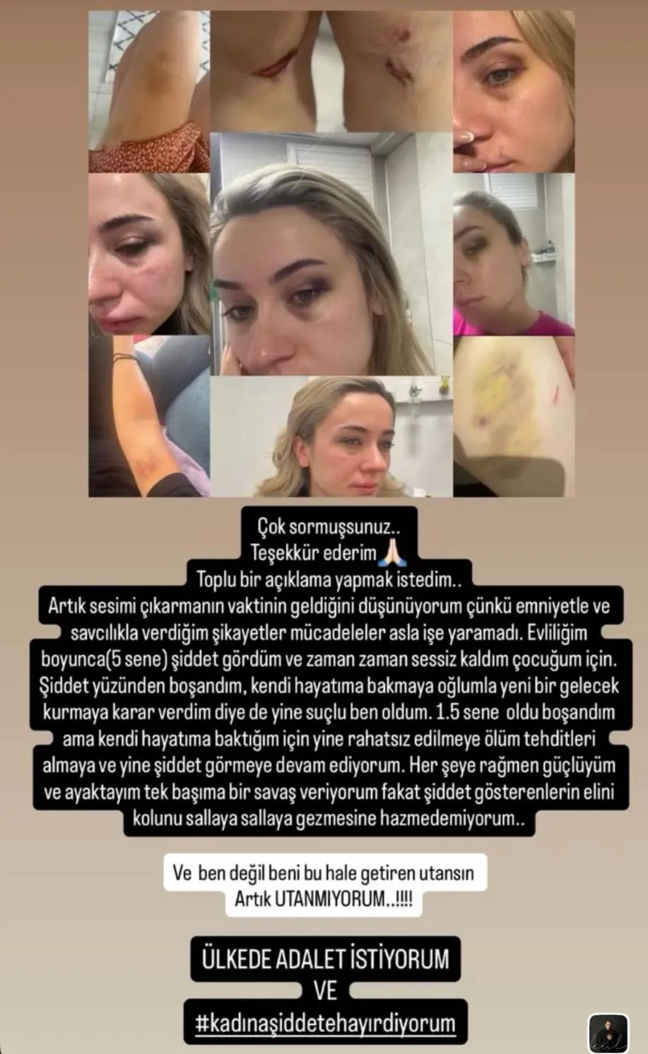 Zonguldak'ta eski eşine şiddet uygulayan adama stadyumda meydan dayağı