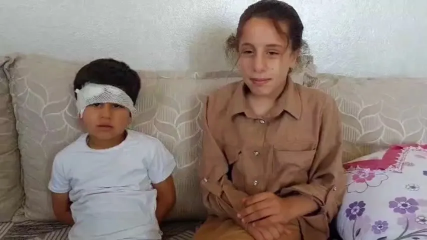Şanlıurfa’da köpek dehşeti 8 yaşındaki çocuk son anda kurtarıldı
