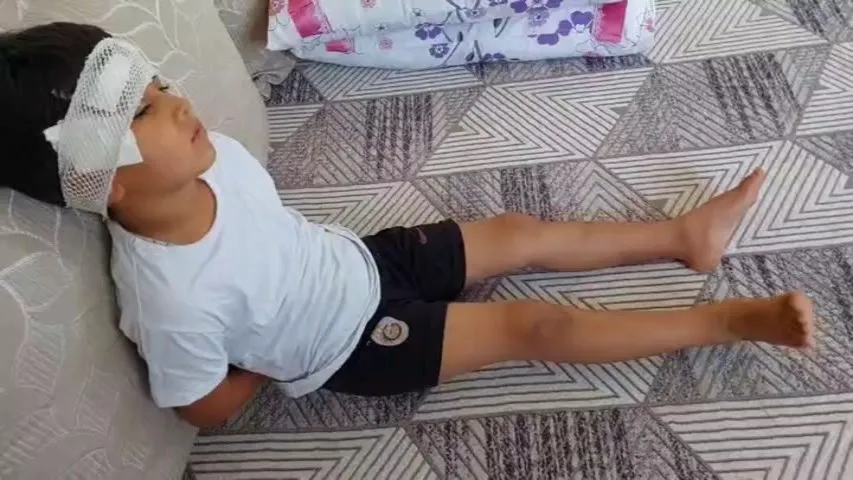 Şanlıurfa’da köpek dehşeti 8 yaşındaki çocuk son anda kurtarıldı