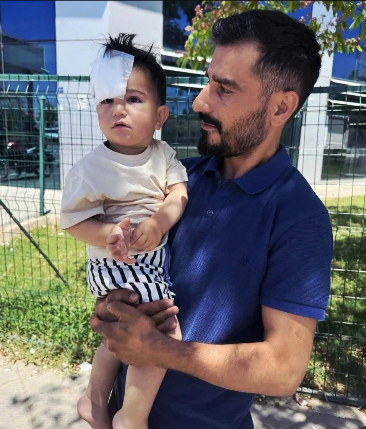 Halfeti'de küçük çocuğa sokak köpeği saldırdı