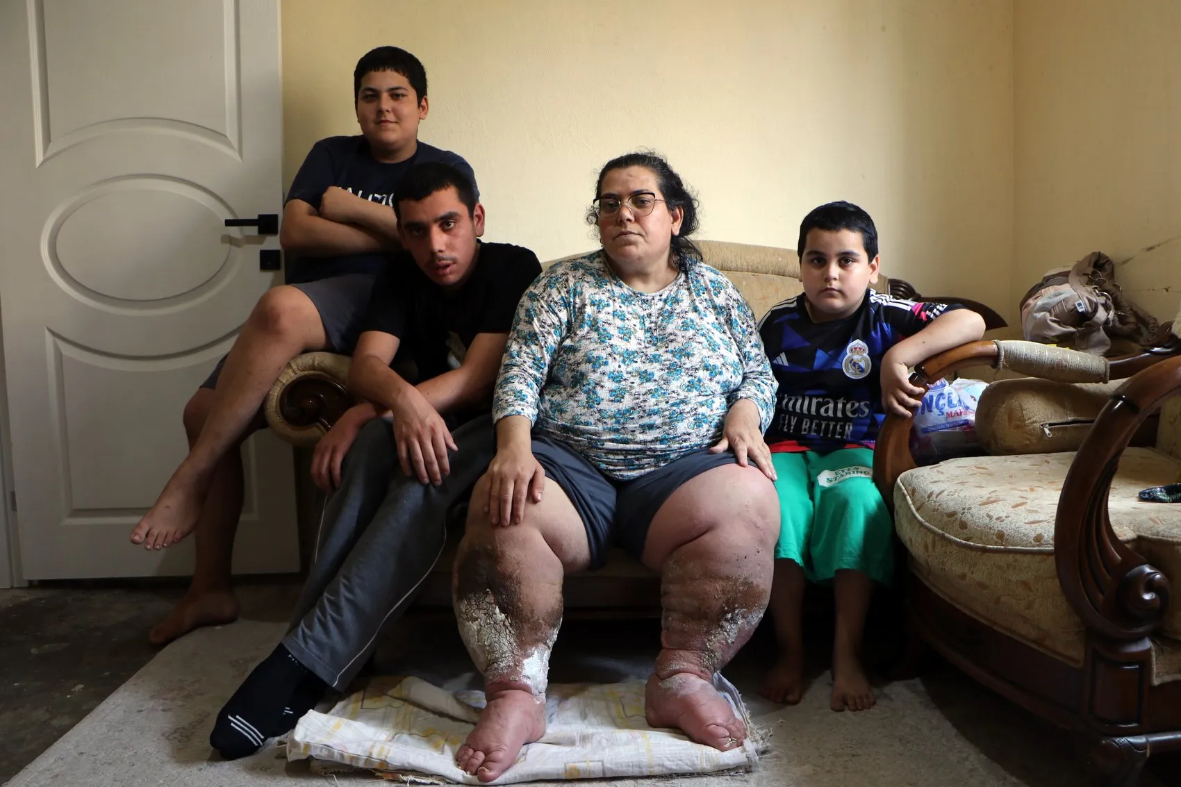 Adana'da yaşam mücadelesi veren anne tedavi olmak istiyor
