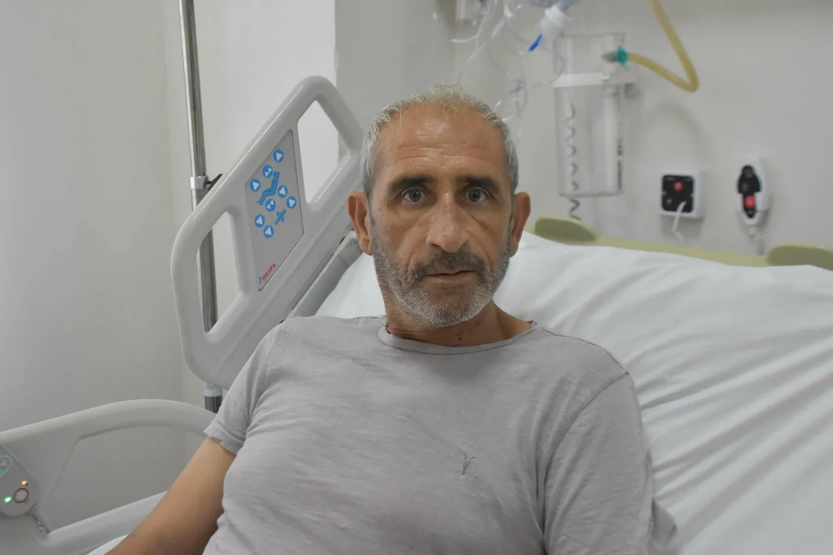 Göğüs kemiğini kesmeden kalpteki tümörü temizlediler