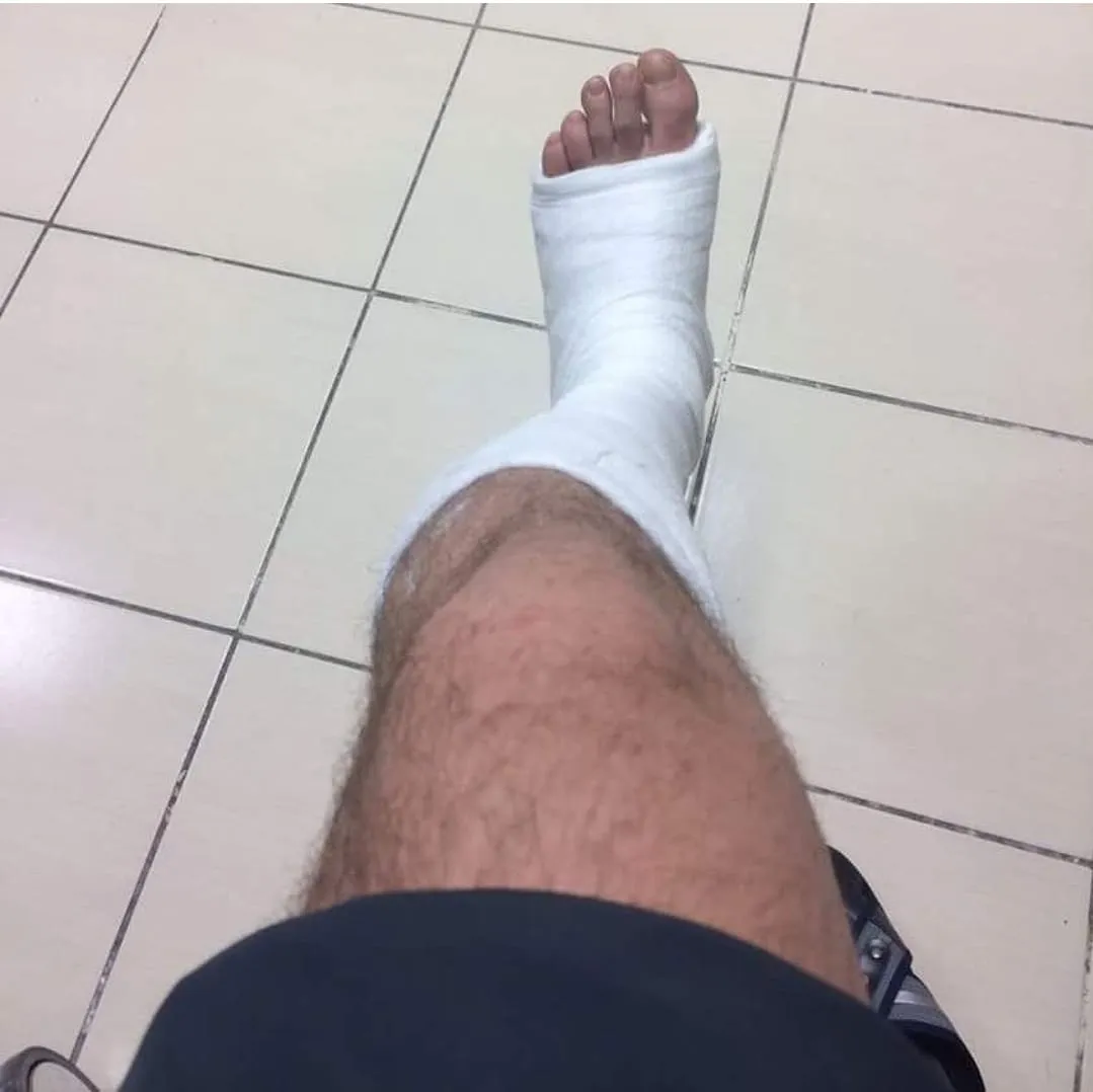 Ayağındaki alçıyı kırıp sokağa çıktı 15 Temmuz şehidi Selim Cansız