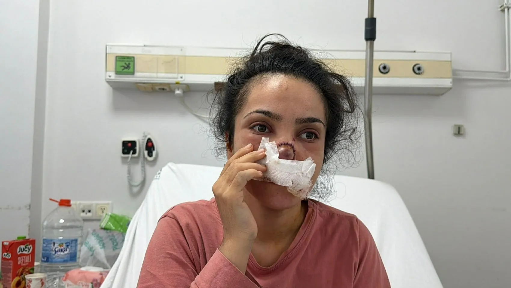 Manisa’da dehşet anları Eşi tarafından burnu koparıldı