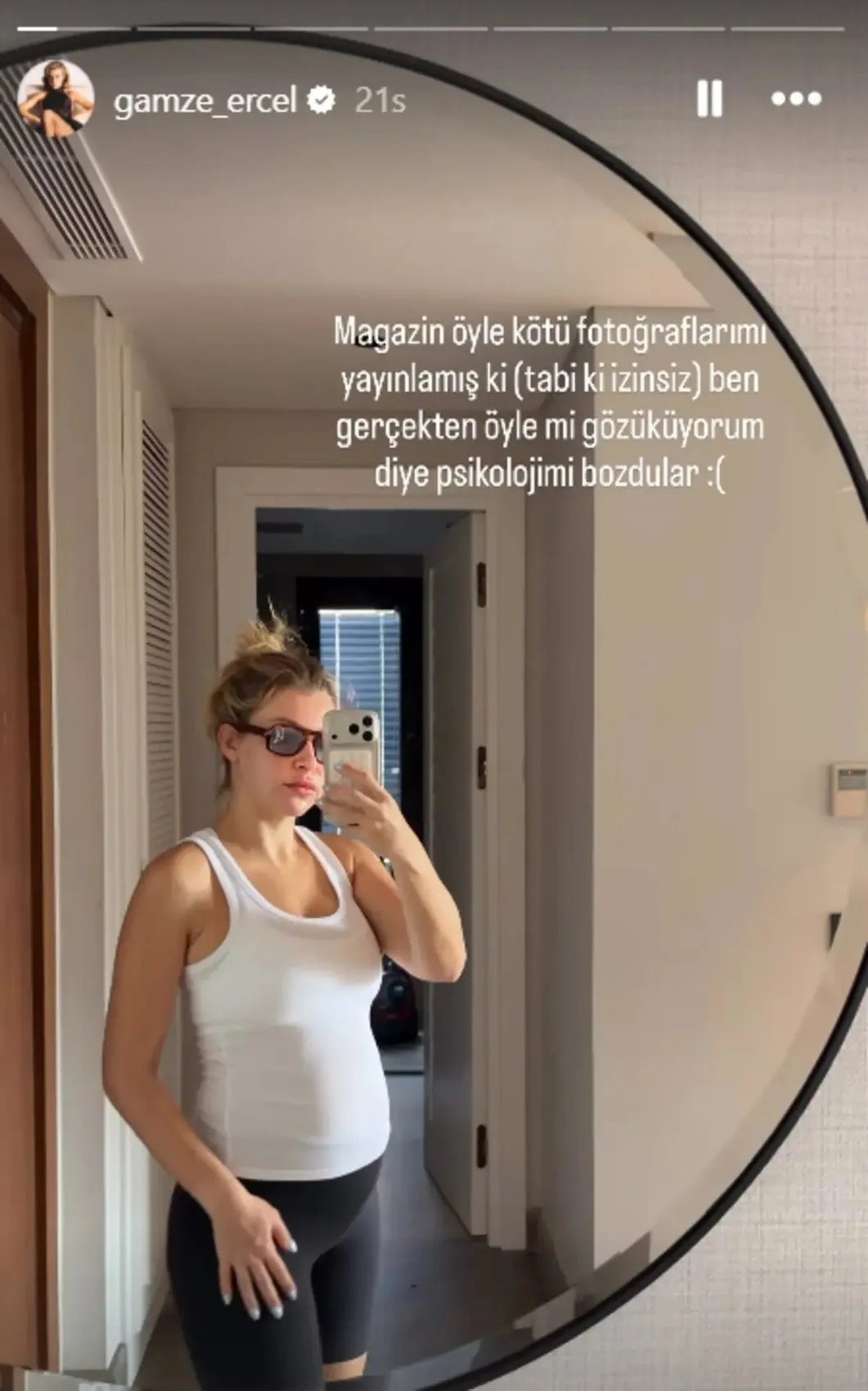 Gamze Erçel bikinili halinden rahatsız oldu! "Psikolojim bozuldu" 1