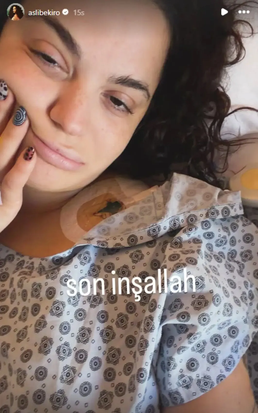 Doktor hatası hayatını kabusa çevirdi: Aslı Bekiroğlu 8. kez ameliyat olacak 2
