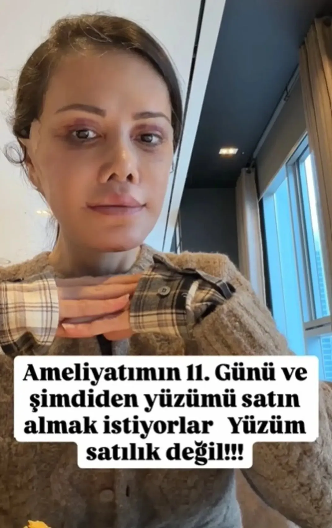 Didem Ceran Kore de yüz nakli yaptırmıştı! Cenazen ülkeye dönsün yorumlarına sert çıktı 3