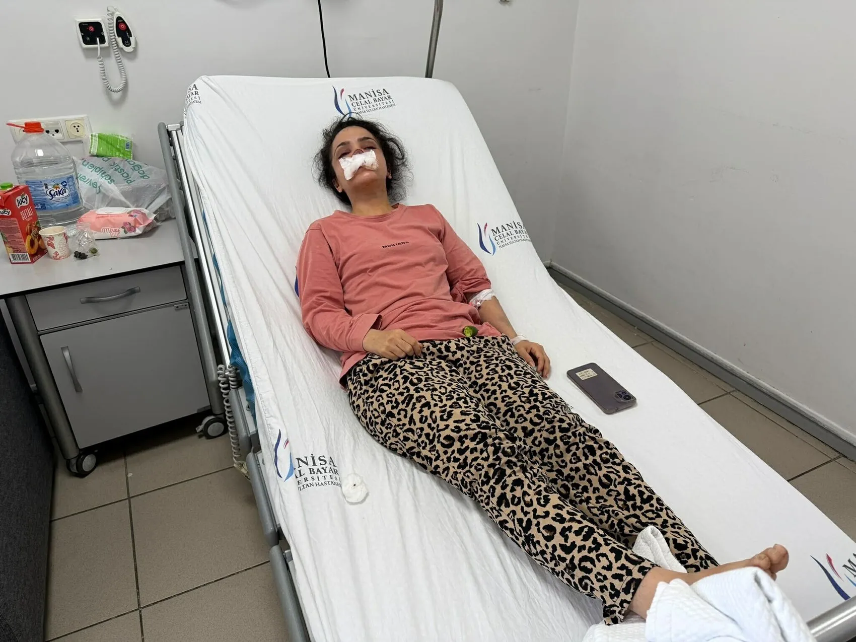 Manisa’da dehşet anları Eşi tarafından burnu koparıldı