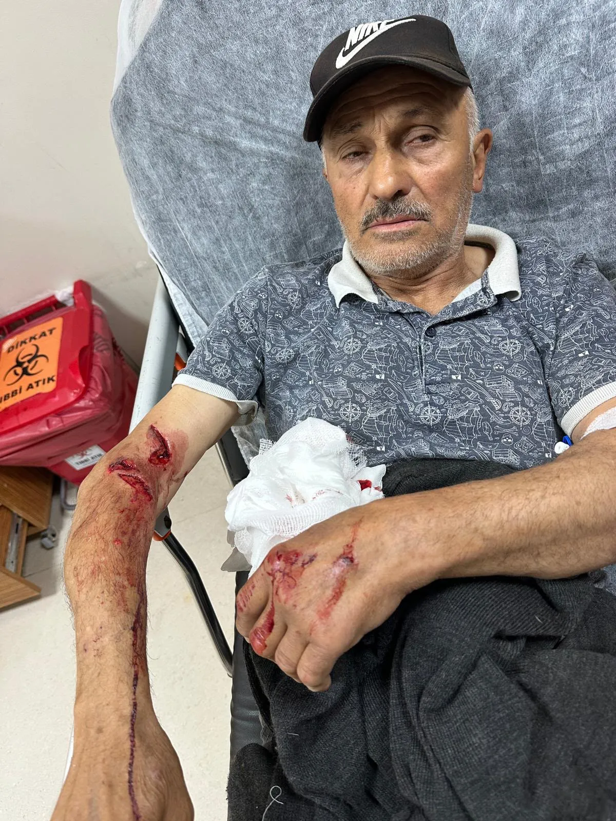 Ordu’da sokak köpekleri skuter süren çocuğu kovaladı