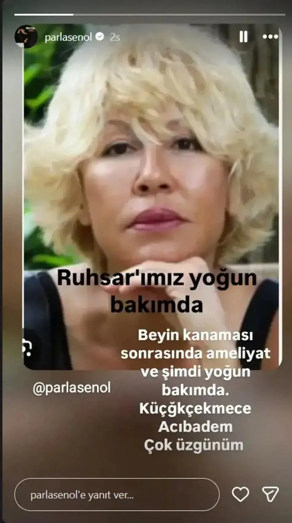 Oyuncu Ruhsar Gültekin beyin kanaması geçirdi! 2