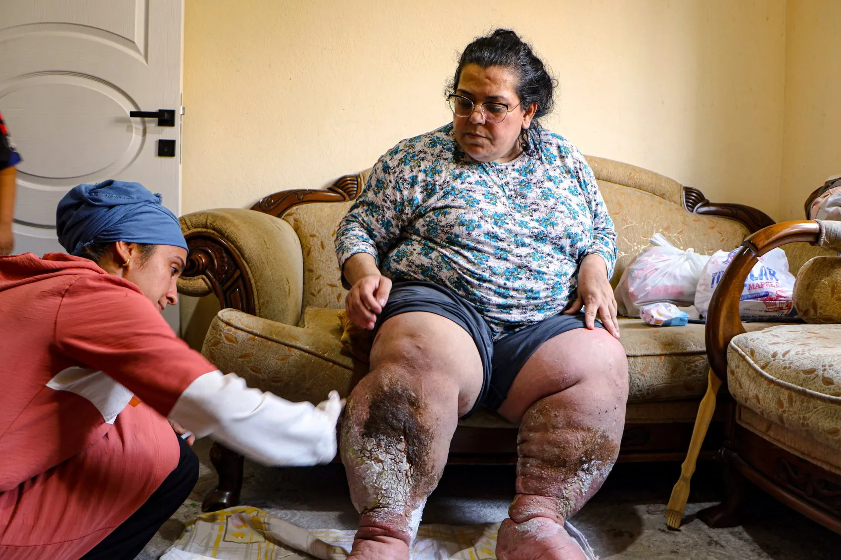 Adana'da yaşam mücadelesi veren anne tedavi olmak istiyor