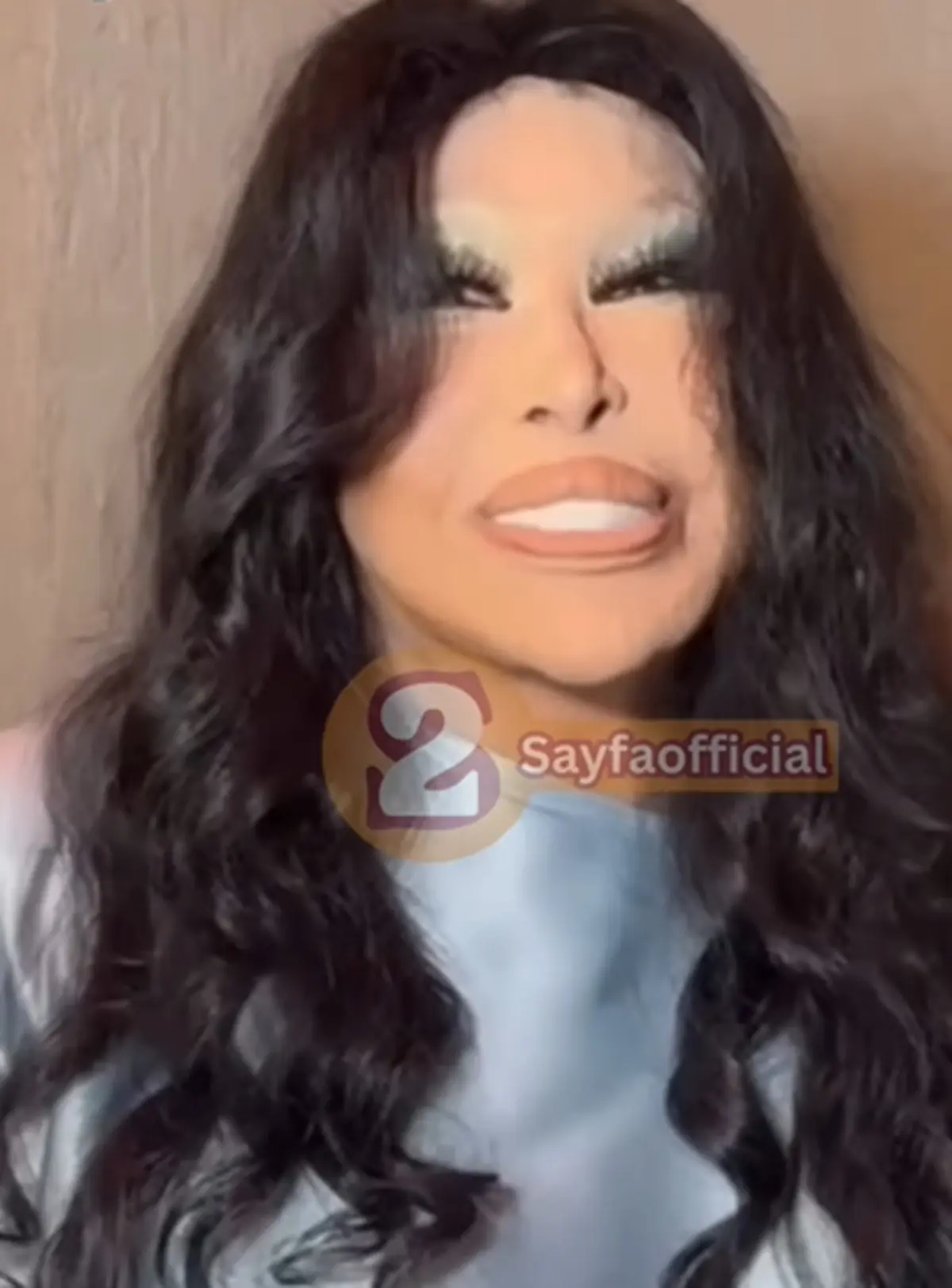 Bülent Ersoy Lolita Lift operasyonu yaptırdı! Son hali ortaya çıktı 3