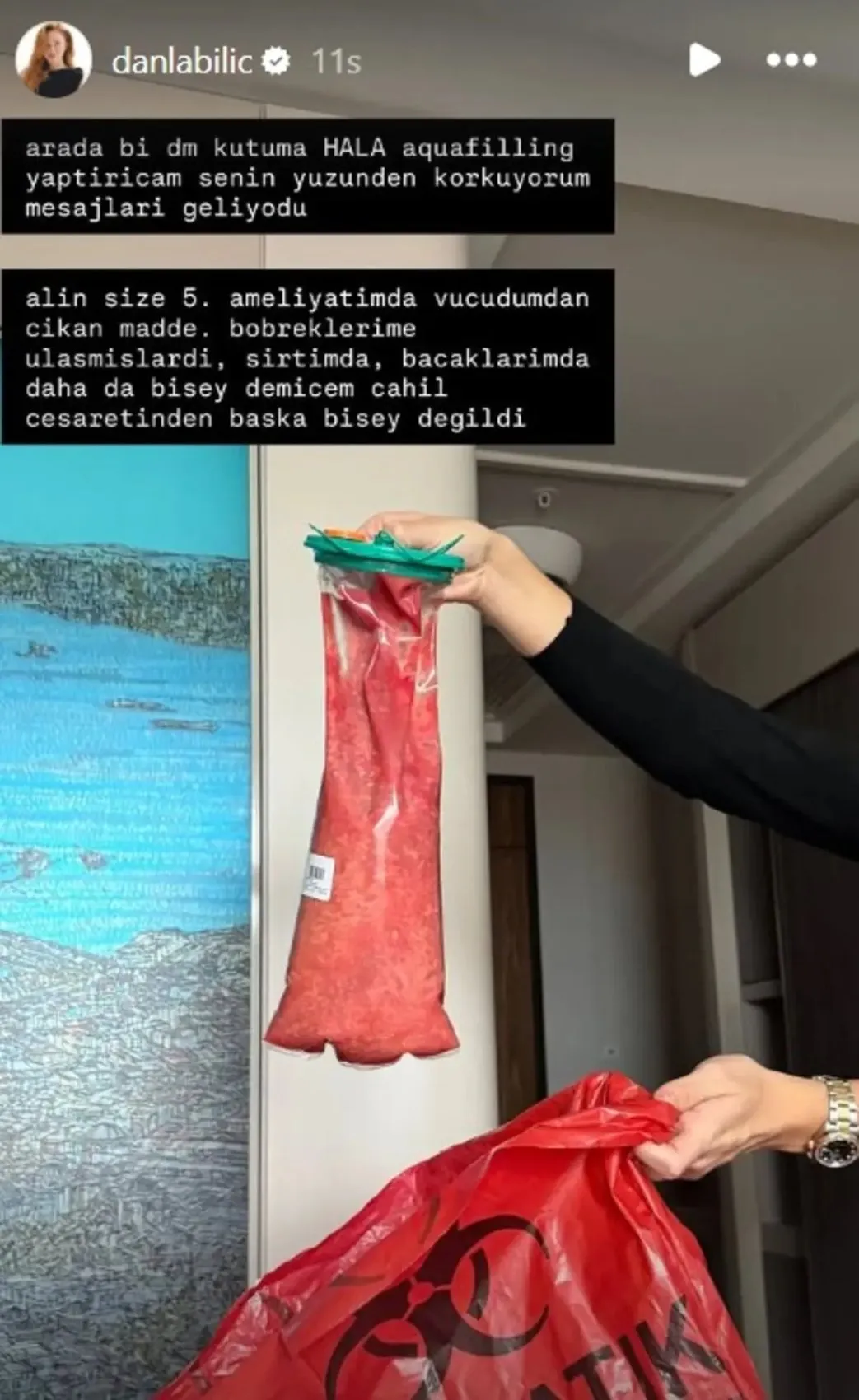 Danla Bilic hakkında korkutan iddia! Durumu ağırlaştı, hastaneye kaldırıldı 2