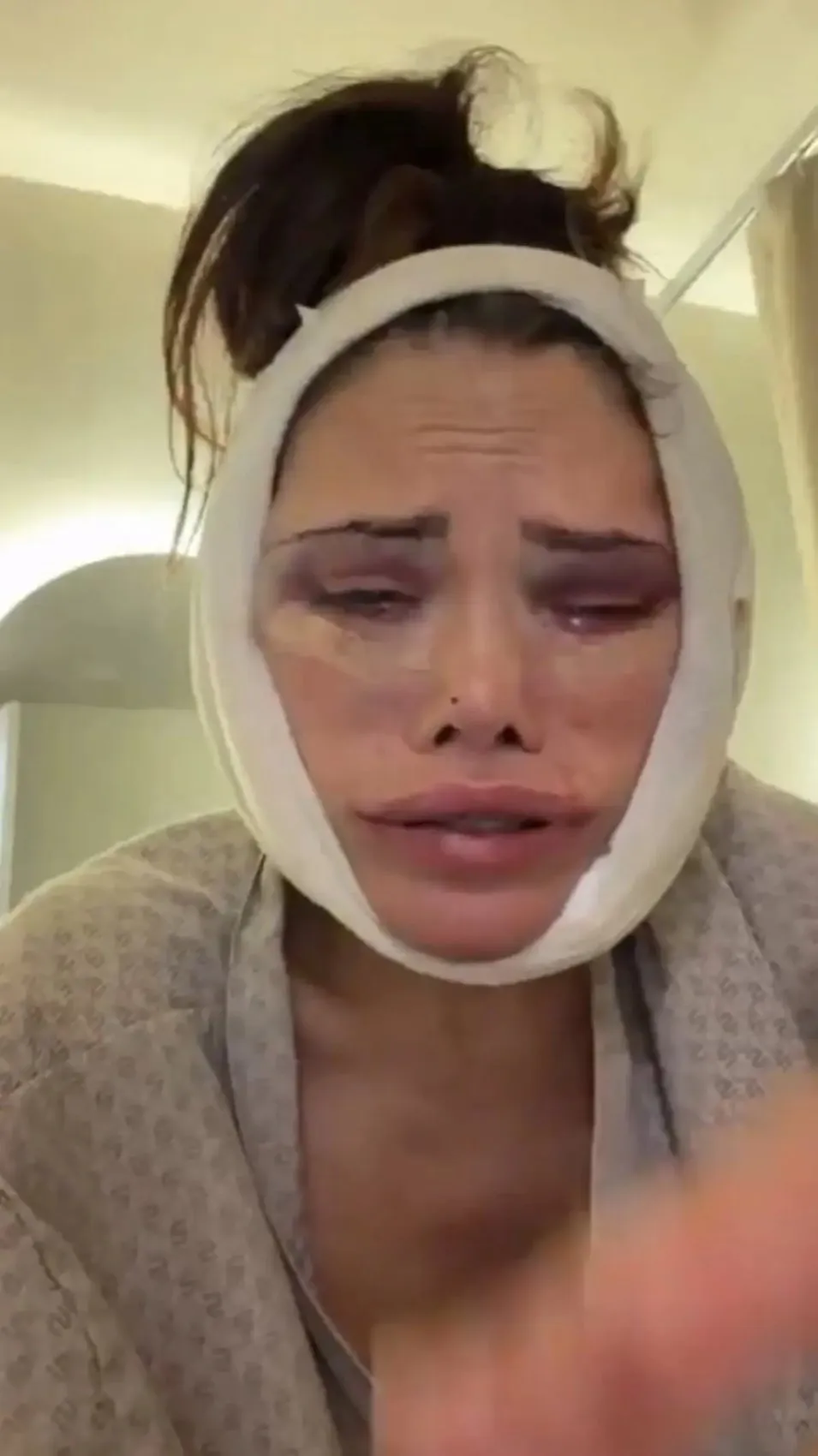 Kore de yüz nakli yaptırmıştı! Didem Ceran bir kez daha bıçak altına yattı! Son haline kimse dayanamadı 3