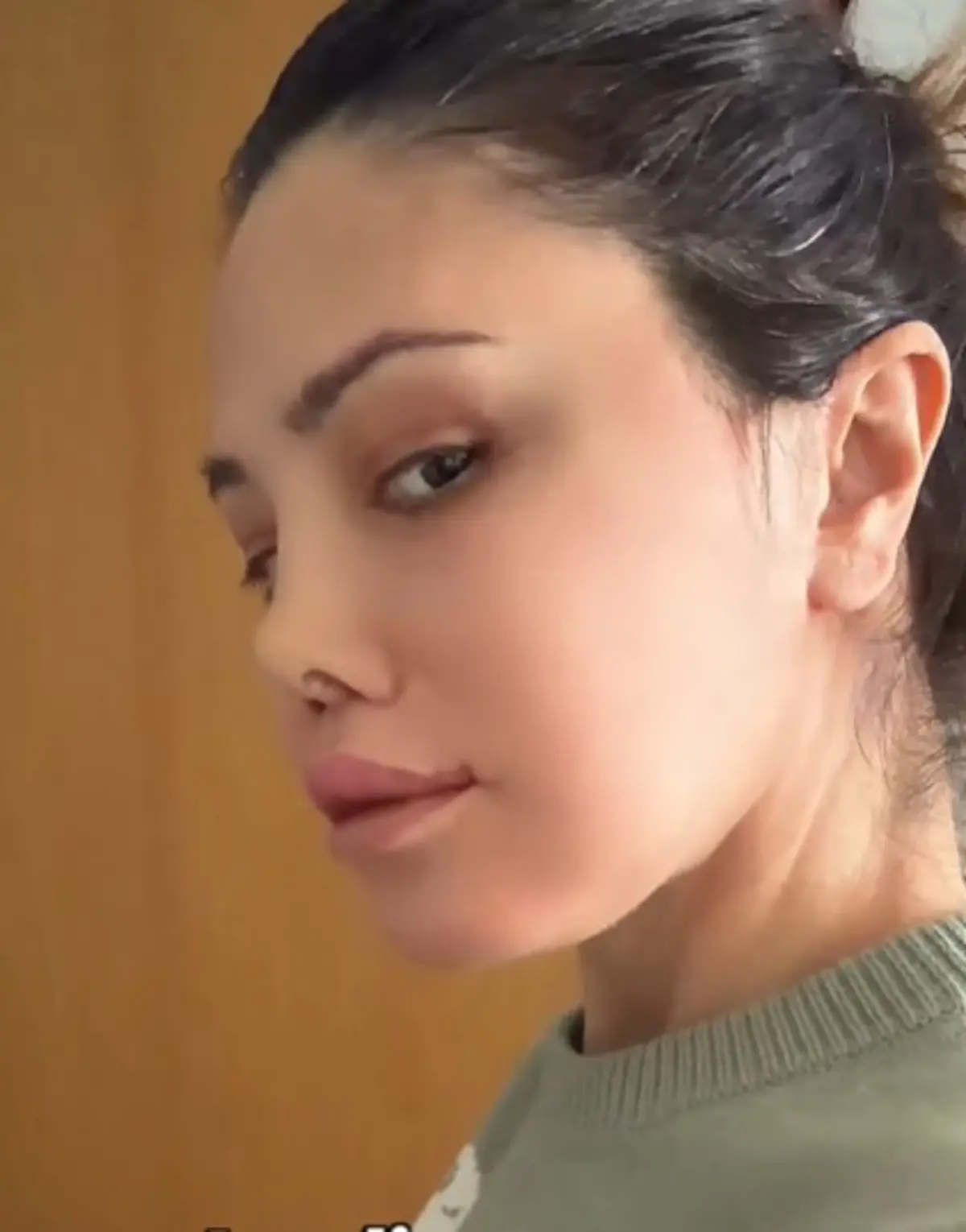Yüz naklinin ardından revizyon ameliyatı olmuştu! Didem Ceran son haliyle yine gündemde 1