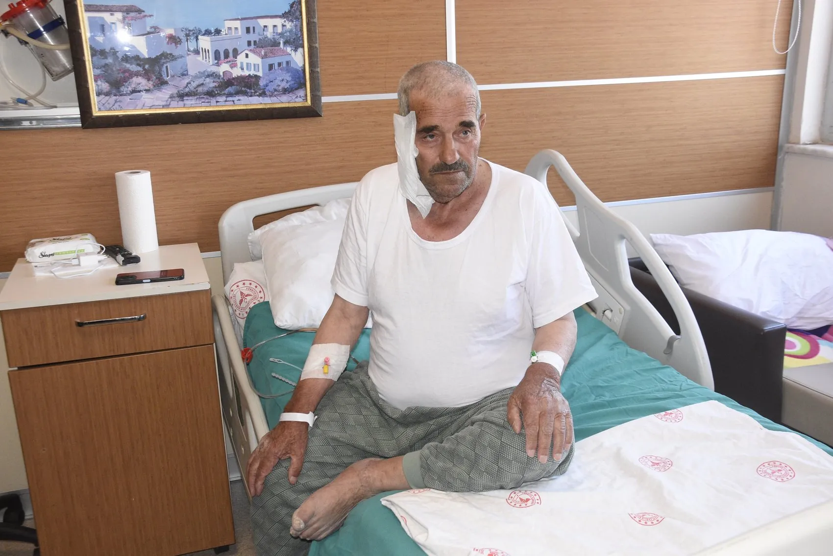 Bitlis'te bir ilk Tükürük bezi tümörü yerinde tedavi edildi