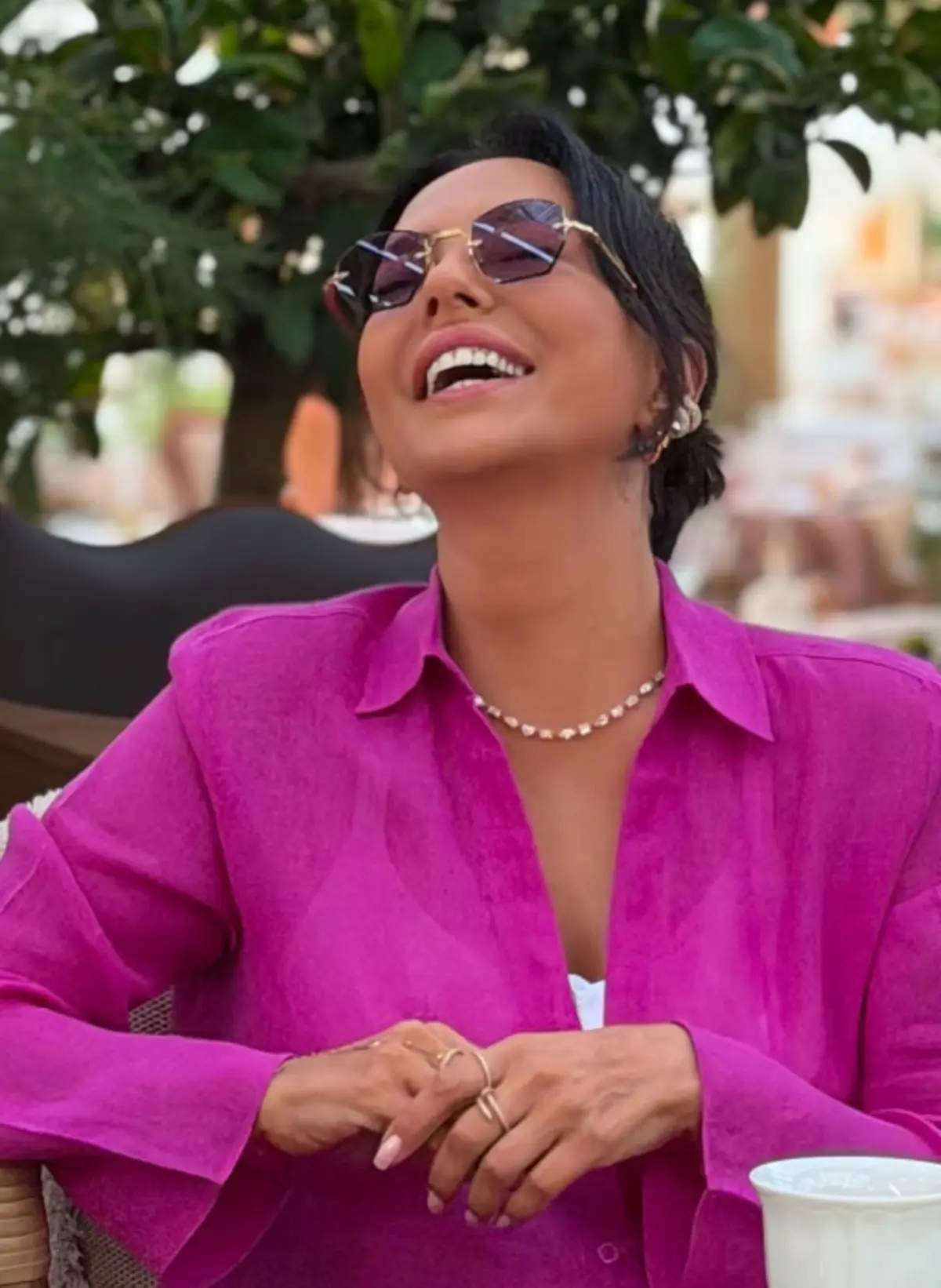 Estetiğe 10 milyon lira harcamıştı! Ebru Gündeş in son hali herkesi şaşırttı 3