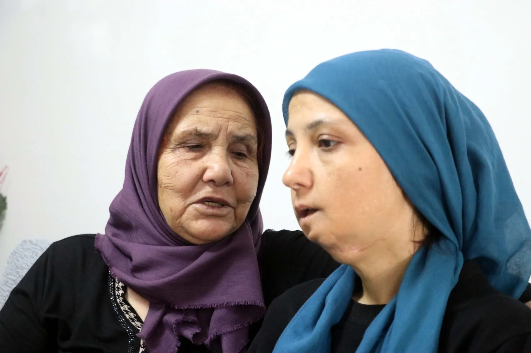 Gaziantepli annenin yaşam mücadelesi 35 ameliyat sonrası tek umudu yardım