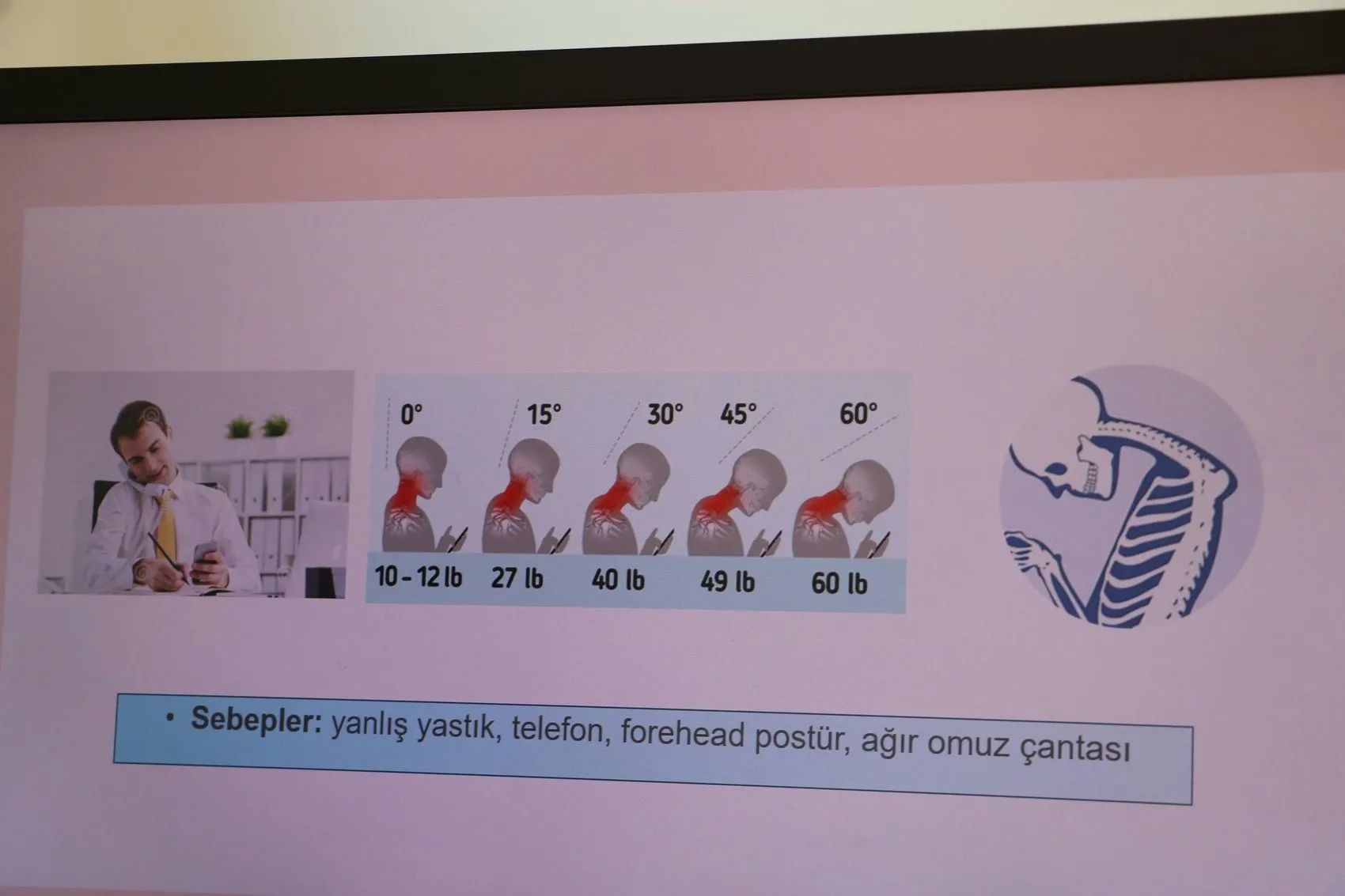 Dijital çağın sessiz tehlikesi: Telefonunuza bakarken boynunuzda 25 kilo taşıyor olabilirsiniz