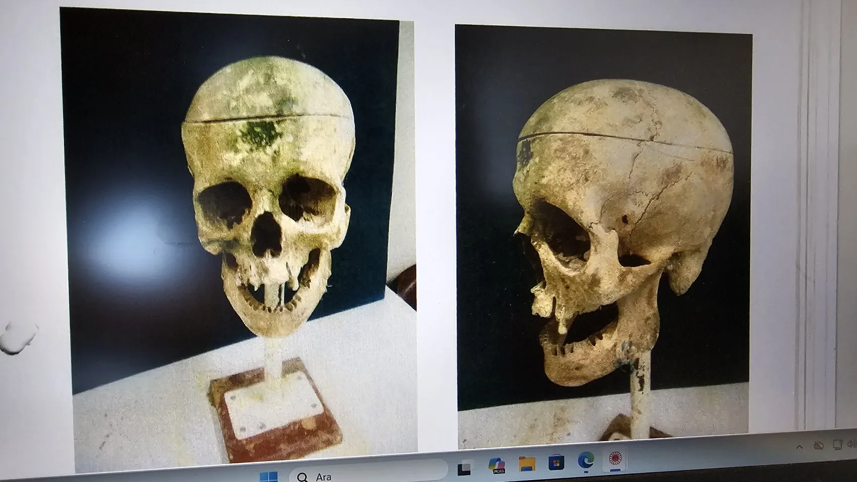 Kelepçeyi Kırıp Kaçan Cinayet Azmettiricisi Zonguldak'ta Yakalandı