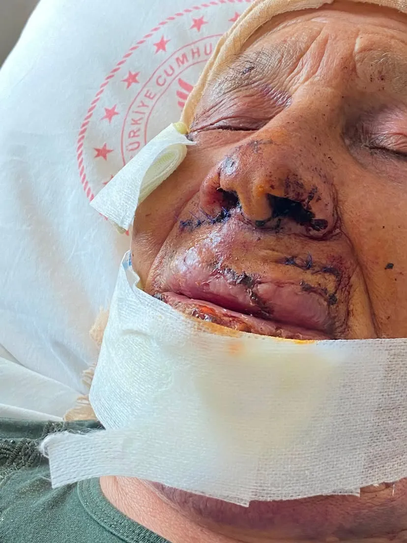 Şanlıurfa'da dehşet verici şiddet Oğlu 85 yaşındaki annesini sopayla yaraladı