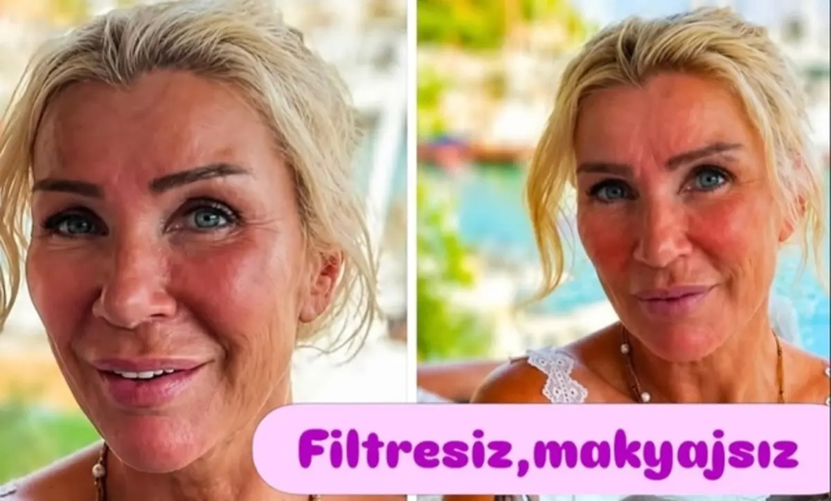 "Filtresiz, makyajsız" fotoğraf krizi! Seda Sayan çileden çıktı 1