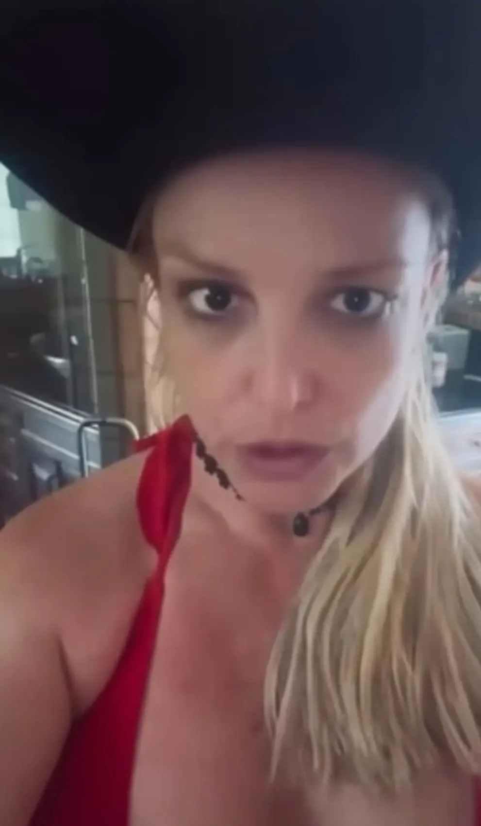 Britney Spears, hatalı botoks işlemi yaptırdığını açıkladı: Gözü haftalarca düşük kaldı 2