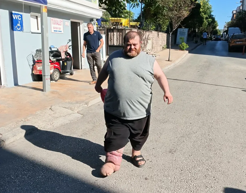 82 kilo veremezse tedavi yok, Kazım'ın tek hedefi sağlığına kavuşmak