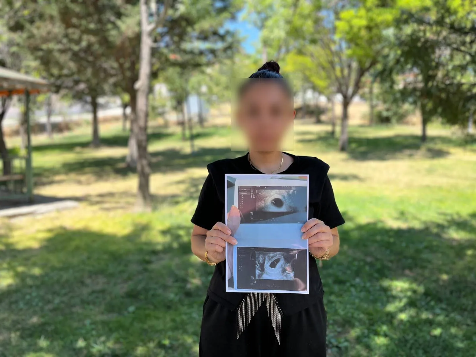 Bebek yaşıyor dendiği hastanede kürtaj için 30 bin lira istediler