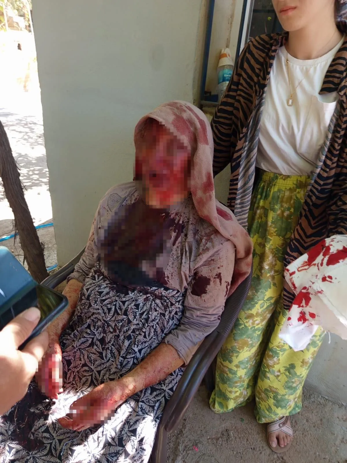 Şanlıurfa'da dehşet verici şiddet Oğlu 85 yaşındaki annesini sopayla yaraladı