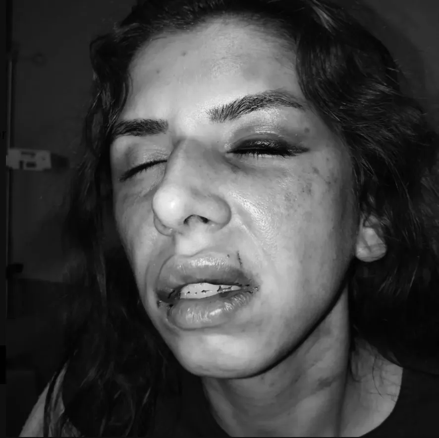 Çekmeköy'de eşini darbeden koca, mahkeme kararıyla cezaevinde