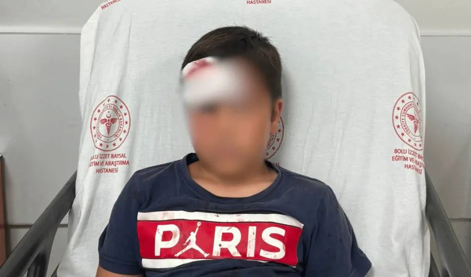 Bolu'da parktaki voleybol direği oyun oynayan çocuğun üzerine devrildi