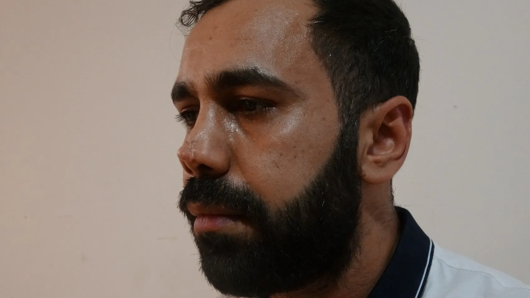 Estetik ameliyat sonrası yüzünde iz kalan hasta hastaneye dava açtı