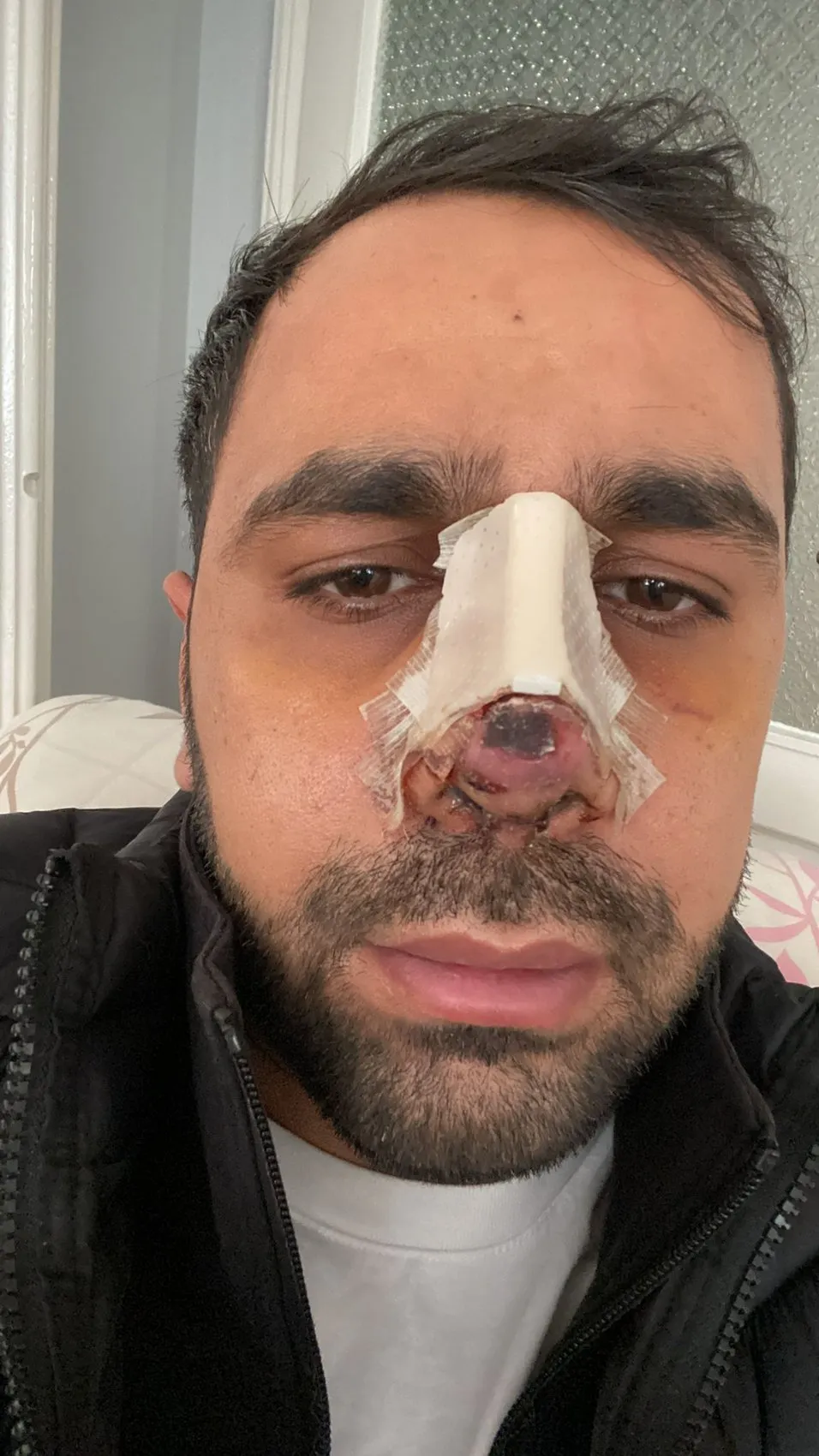 Estetik ameliyat sonrası yüzünde iz kalan hasta hastaneye dava açtı