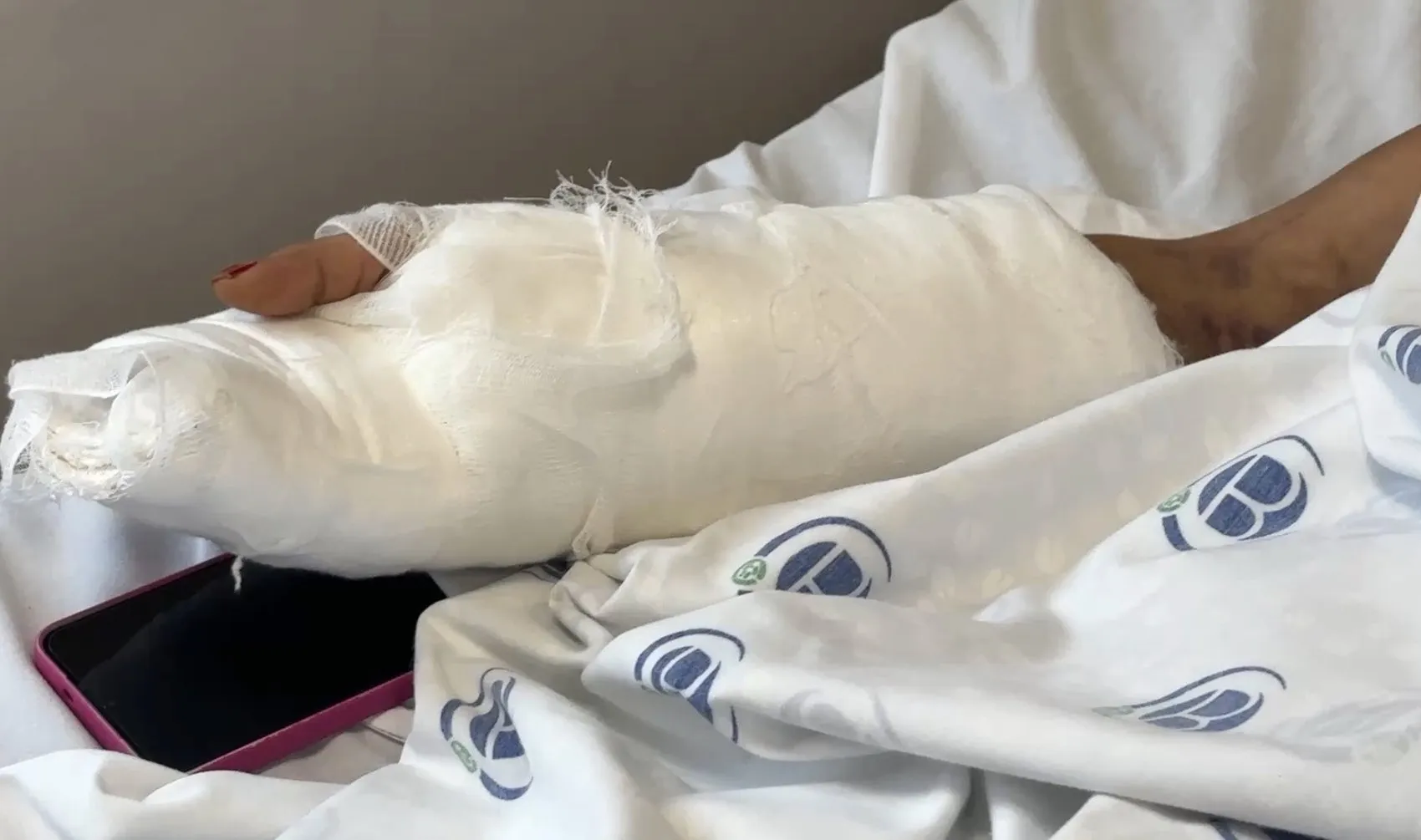 Eski eşinin dehşeti sonrası Ayşe Katırcı hastanede yaşam mücadelesi veriyor